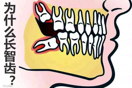 人為什么會長智齒,智齒一定要拔嗎