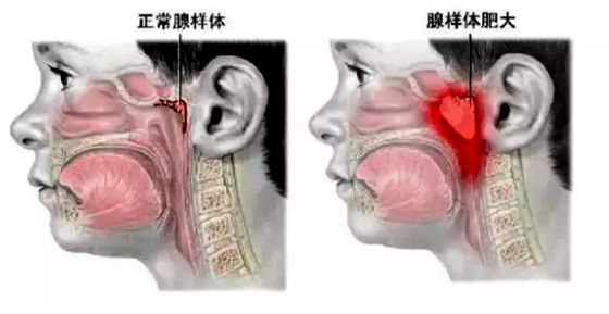 人為什么要用鼻子呼吸,用鼻子呼吸的好處