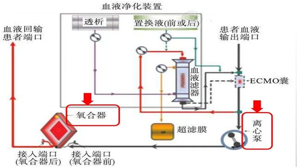 ECMO是什么意思,ecmo英語怎么讀,ecmo為什么這么貴